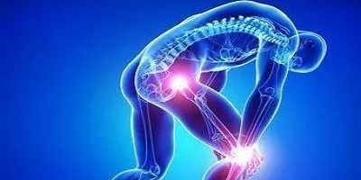 滑膜炎有什么特效药？