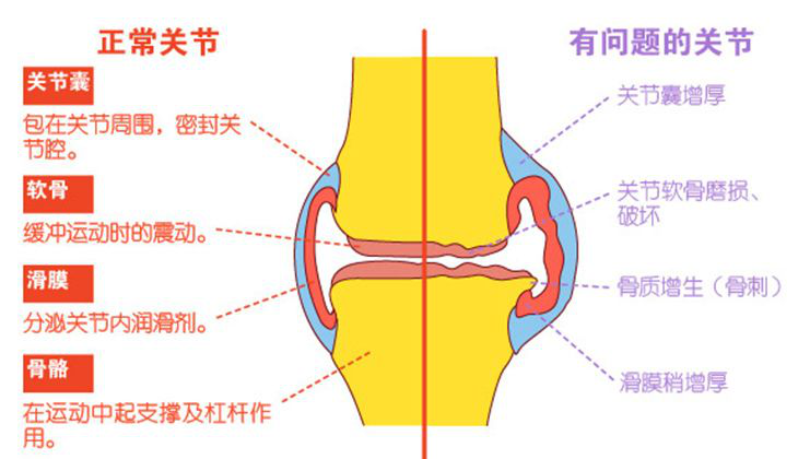 膝关节滑膜