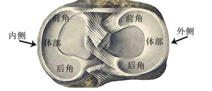 半月板损伤能自愈吗?