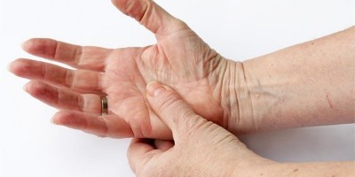手指关节炎的治疗方法