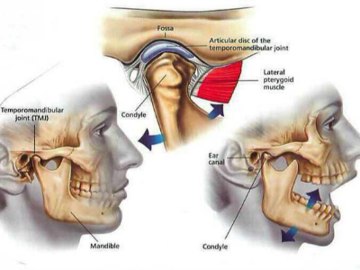 颞颌关节炎