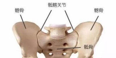 骶髂关节炎