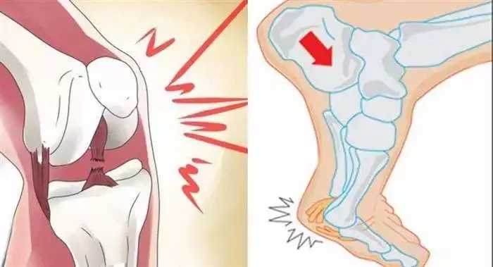 病理性关节响