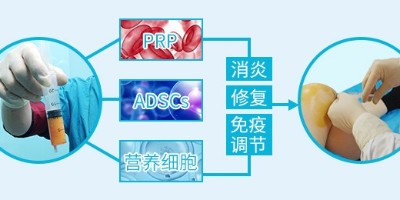 关节损伤修复新技能——腿友之家SVF是什么？