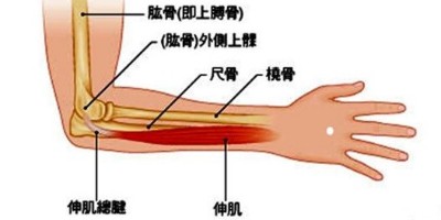 治疗网球肘