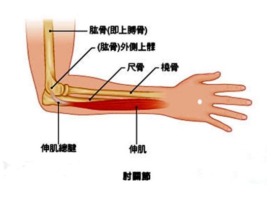 湖北治疗网球肘专业的医院是哪家？