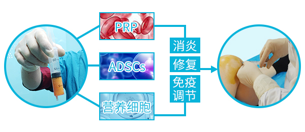 肘关节滑膜炎症状