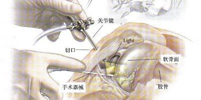 腿友之家：做关节修复注射必须结合关节镜吗？