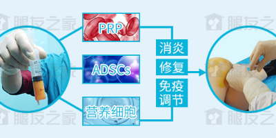 自体脂肪来源复合修复因子SVF的作用机制是怎样的？