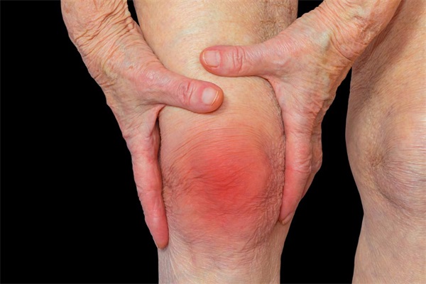 膝关节炎是怎么引起的.jpg