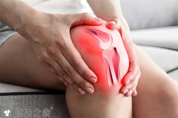 膝关节创伤性关节炎怎么办.JPG