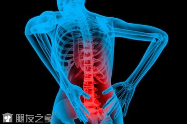腰椎骨性关节炎是什么jpg