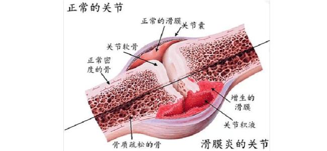 关节腔结构图图片