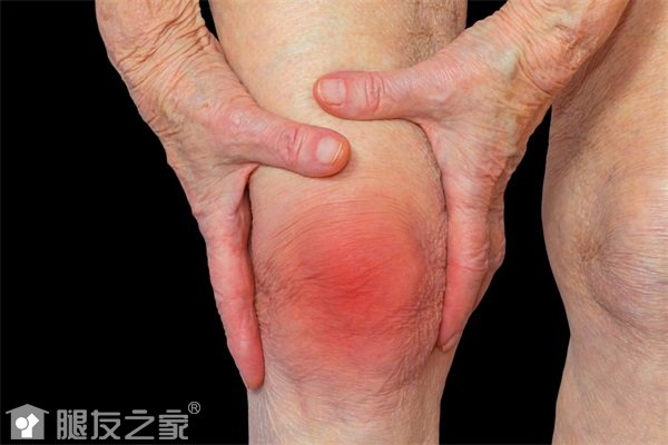 膝关节炎病因是什么.jpg